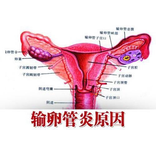 坚持这6点,输卵管问题离你越来越远,附输卵管炎用药