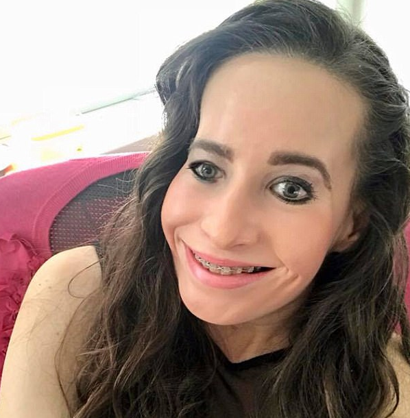 "半脸"女子历经4次手术重建右脸 觉得自己是最幸福的人