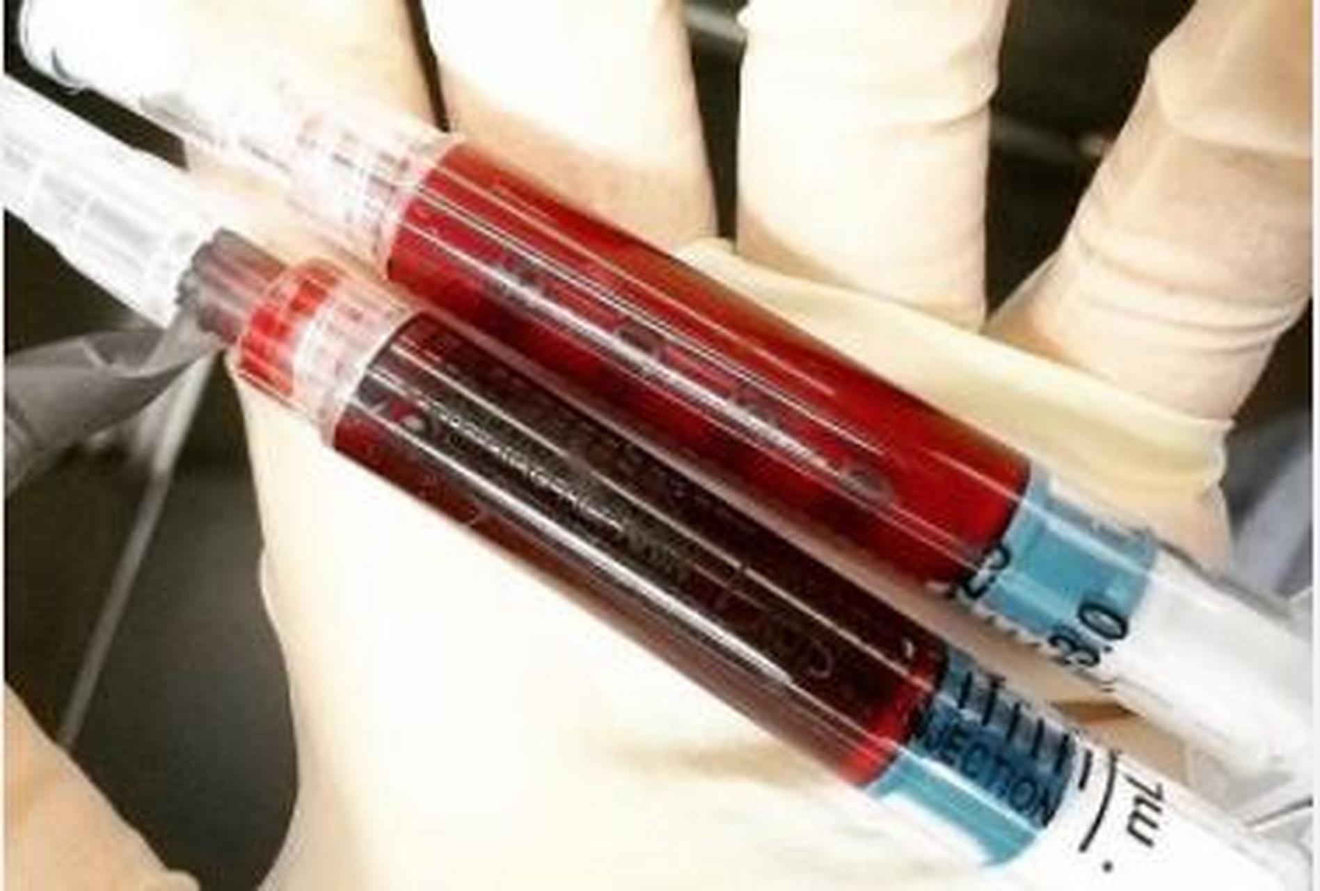 来,猜猜哪支是动脉血哪支是静脉血?