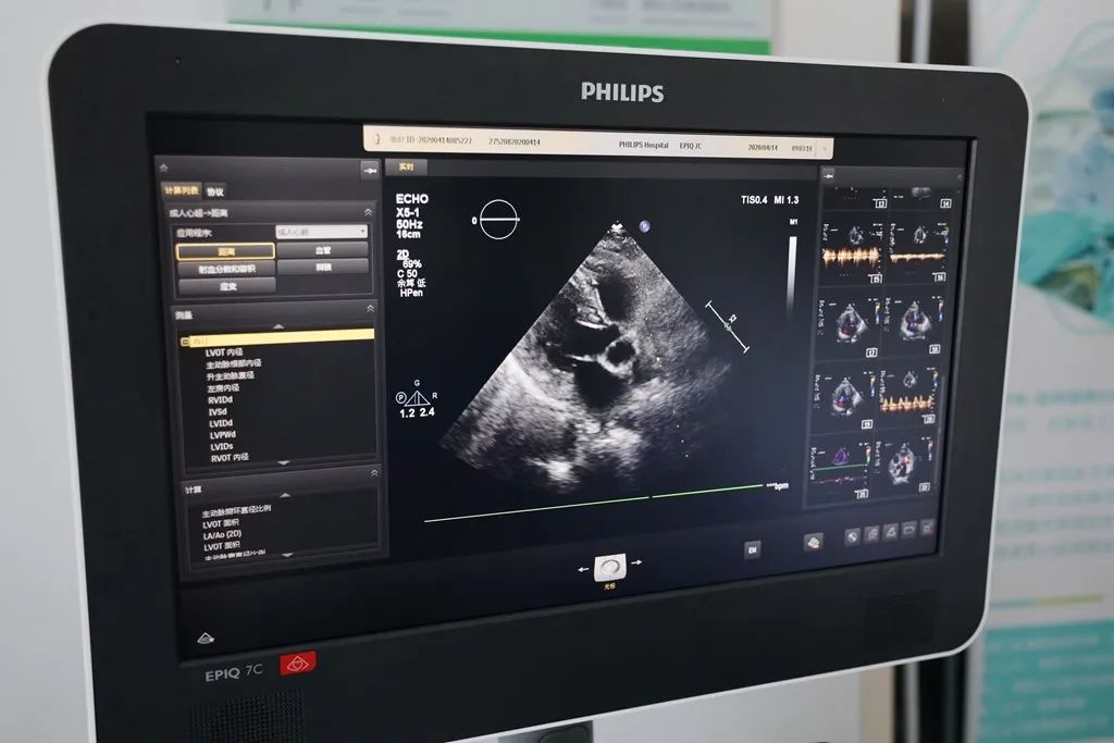 慈林医院最新引进飞利浦 EPIQ7C 高端心脏智能彩超仪