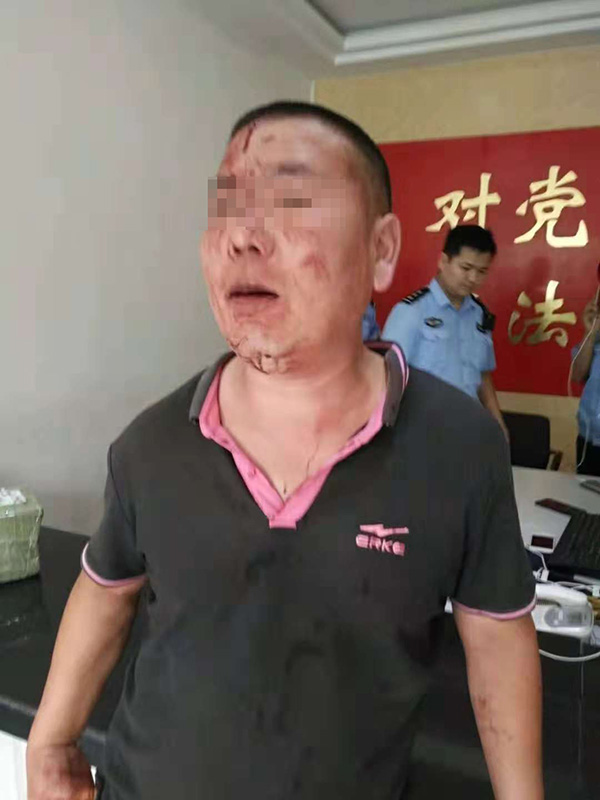 江苏丰县城管殴打个体户致其多处骨折,2人获缓刑2人被管制