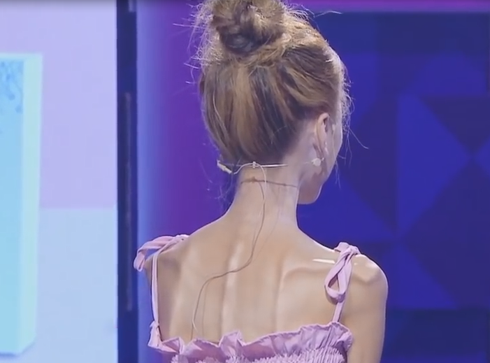 痴情女子为了爱情,疯狂瘦身70斤,等来的却只是网友的诀别书