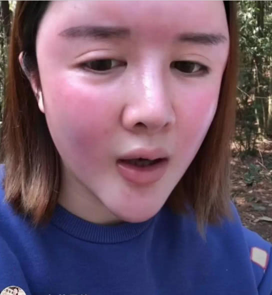 网红整容10次,成功把自己从一个"美女"整成了"胖头鱼"!