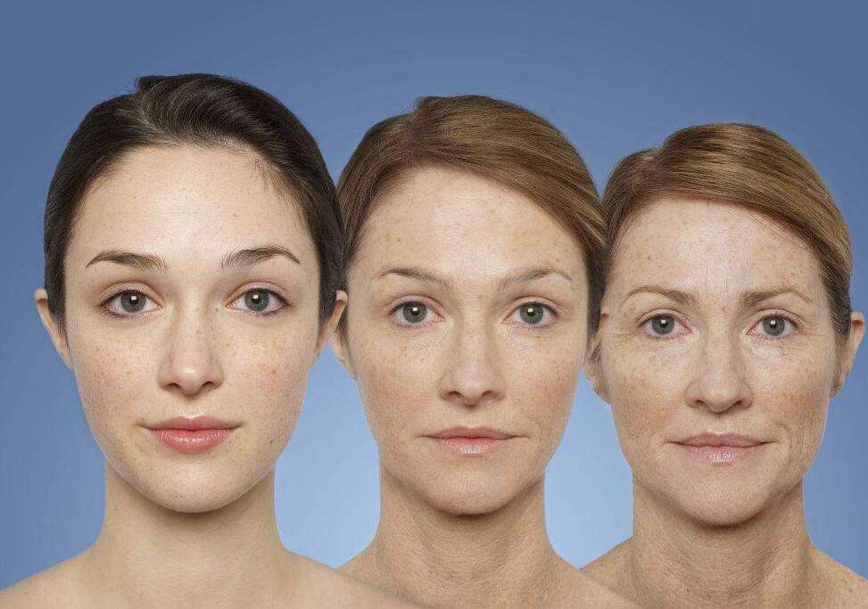 女人开始衰老时,身体这些部位变化较为明显,别不承认