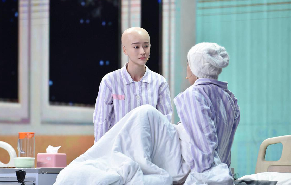 张雪迎首次尝试光头造型,化身癌症患者,获得众网友一致肯定!