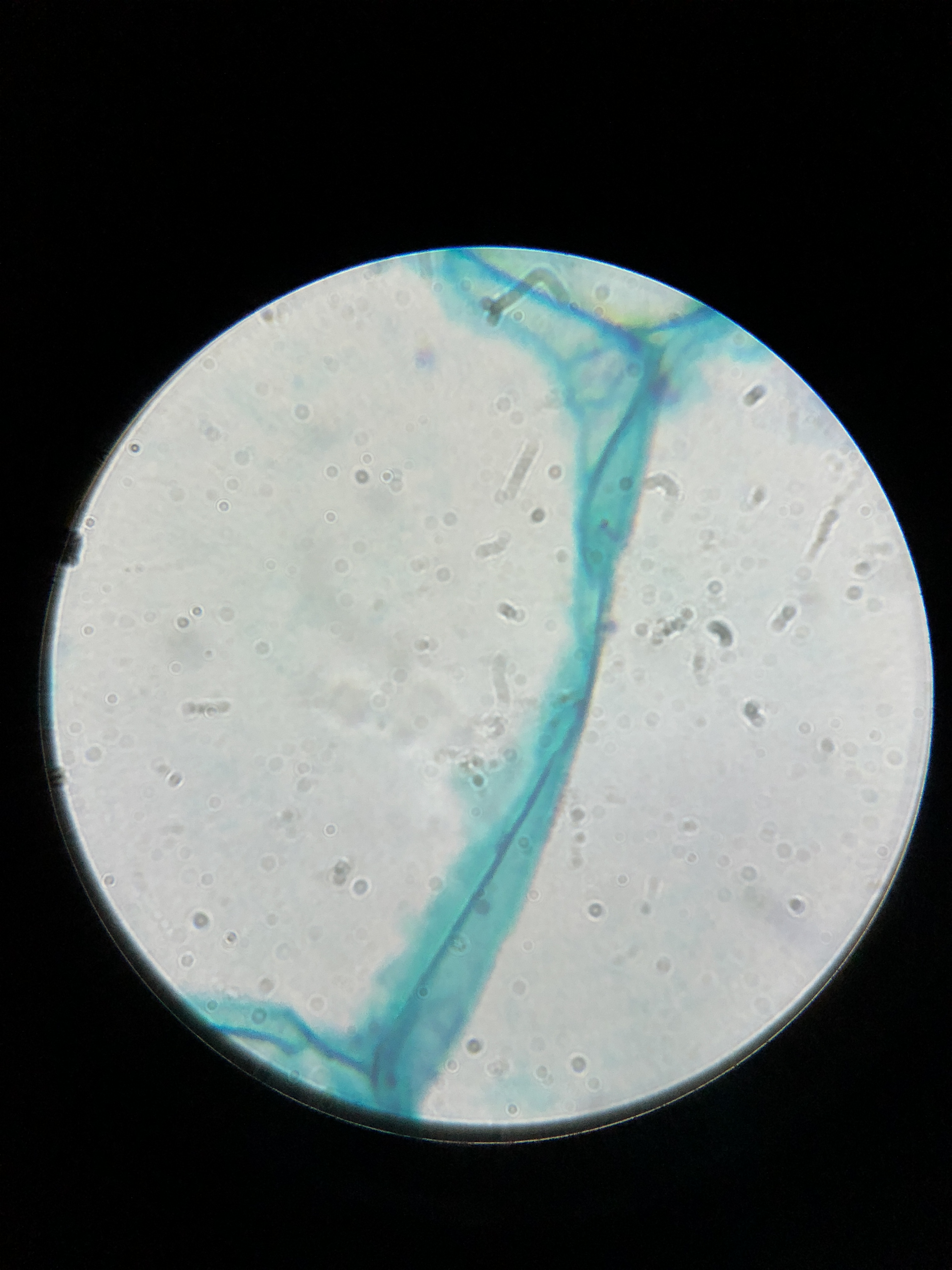 显微镜下的世界——树叶