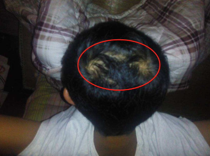 老人说:头旋和智商有关,头旋越多的宝宝,智商也会更高吗?