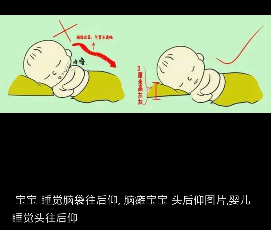 预防未来宝宝脑瘫要注意事项