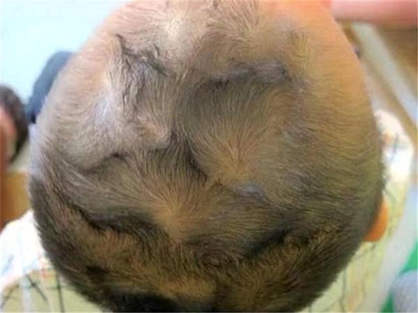 老人说孩子头旋越多脾气越不好,妈妈:那有七个旋怎么说?