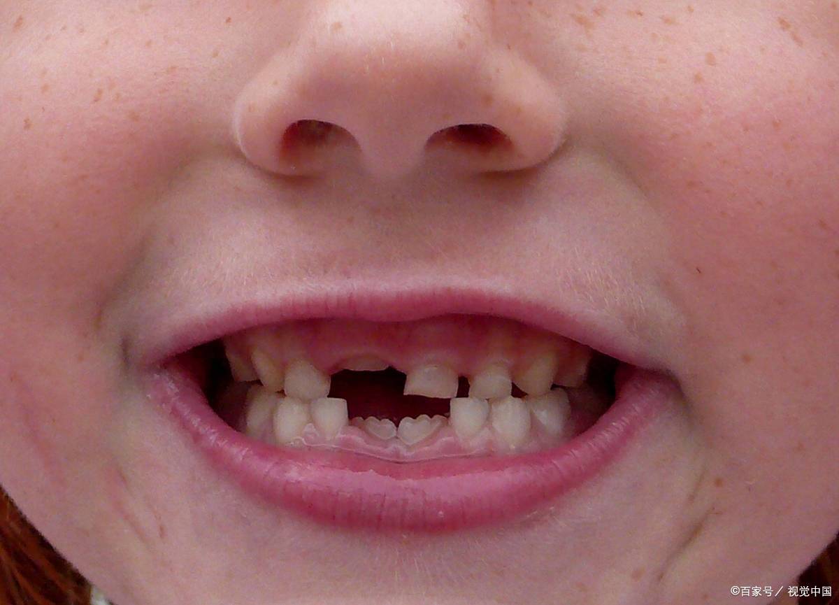 你还记得自己小时候是怎么换的牙?