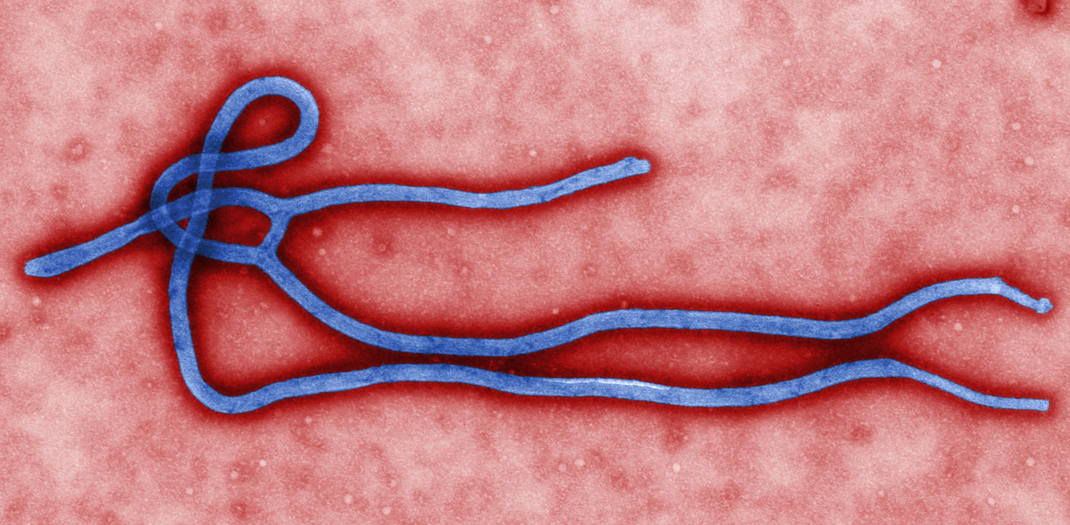 埃博拉病毒的样子图片