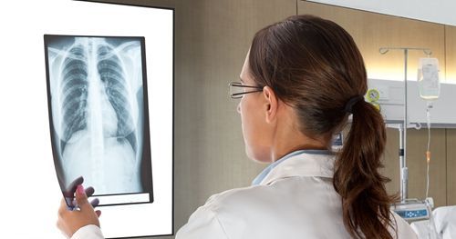 为什么有些女人很抗拒做胸透?这个想法让人哭笑不得,一起看看吧