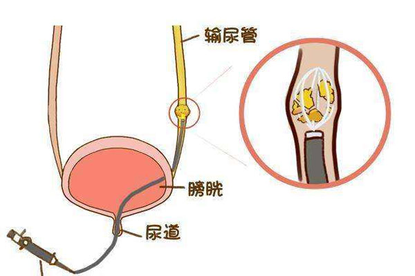 人体输尿管的位置图图片