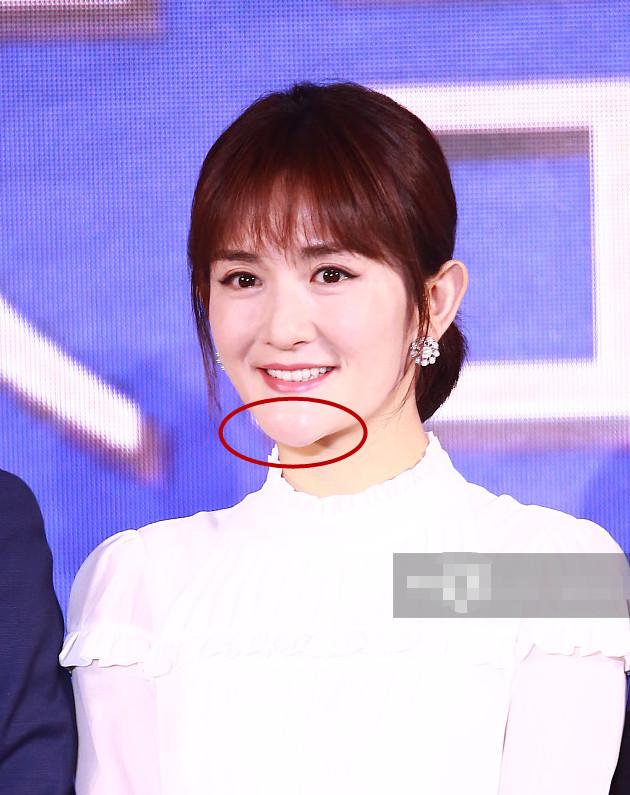 谢娜生娃后衣品简直是神仙级变化,可是这次下巴又怎么了?