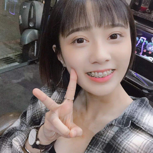 "戴牙套"的女生是什么感觉?经历过,才发现"永生难忘"!