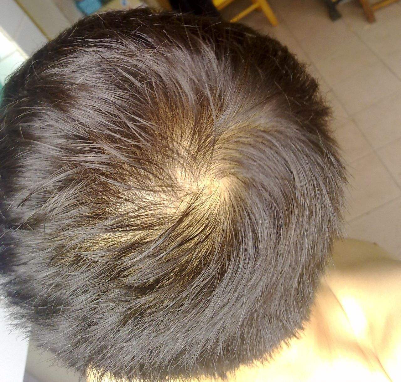 以前人们为什么说头上的发旋越多越聪明?看完才知道被骗了多年!