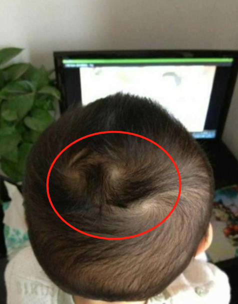 老人说:头旋和智商有关,头旋越多的宝宝,智商也会更高吗?