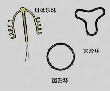 吉尼环 baijiahao.baidu.com