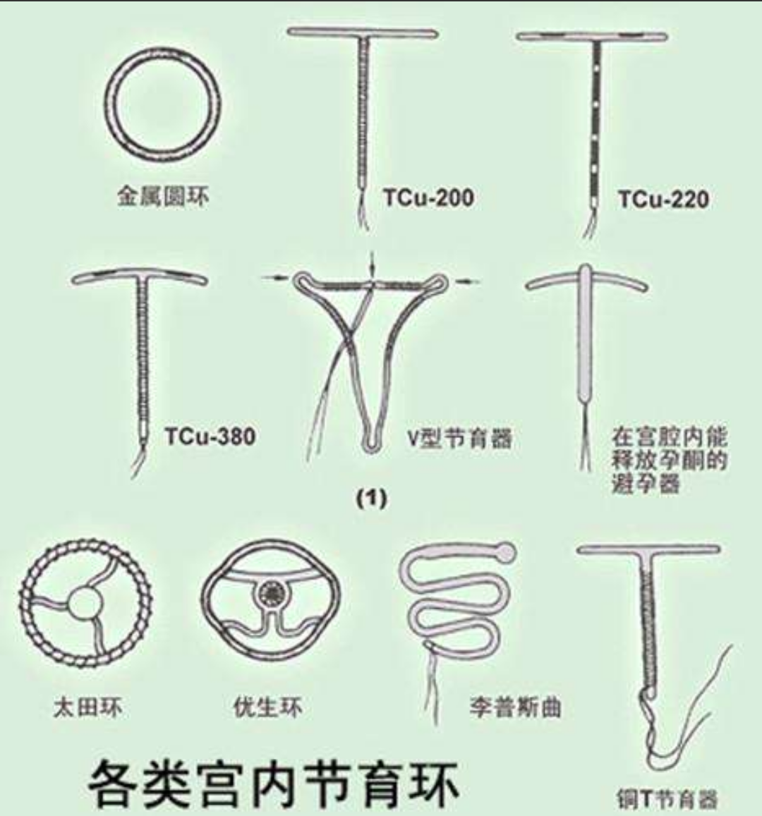 圆环节育环图片图片