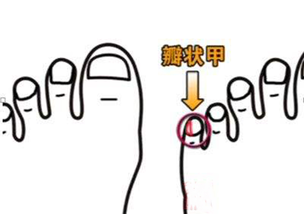 传说中"瓣状甲"的真相,看山西移民热潮与汉人的进化
