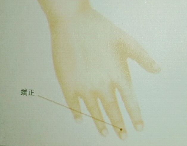 端正穴:补气升阳掐端正