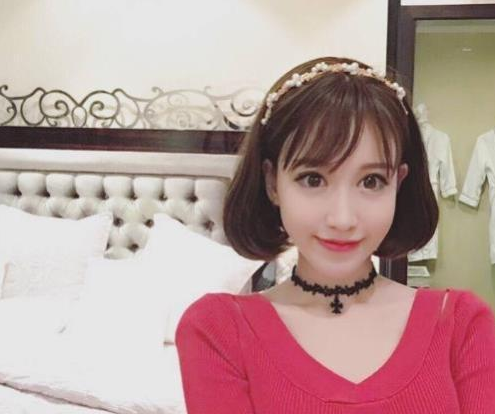 uu"整容"后续,uu:现在脸肿得像癞蛤蟆,奉劝大家不要轻易整容