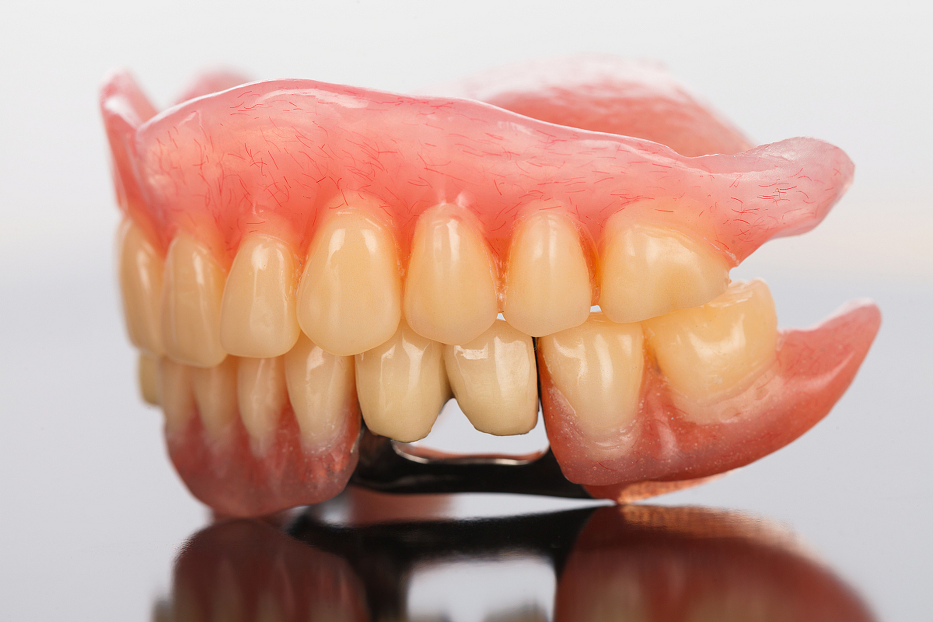 美容牙冠 美容冠是一种快速,有效的牙齿美容方法,通过给牙齿穿上"外套