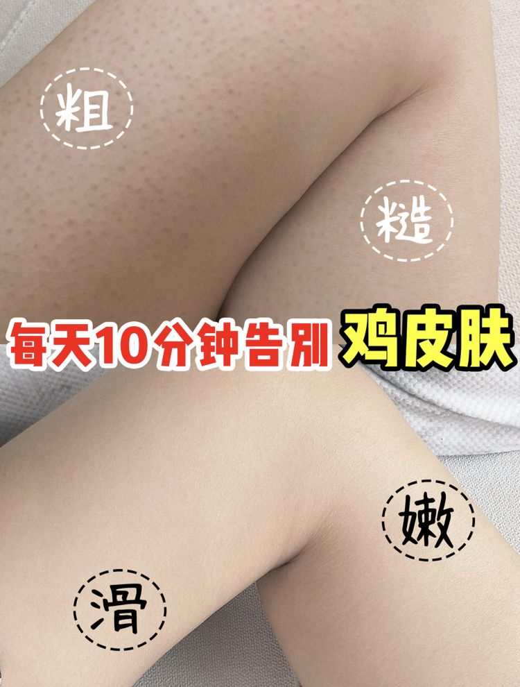 腋毛下的鸡皮疙瘩（腋毛下的鸡皮疙瘩痒）