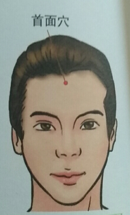 前额头痛难以忍受,首面穴帮忙解决!