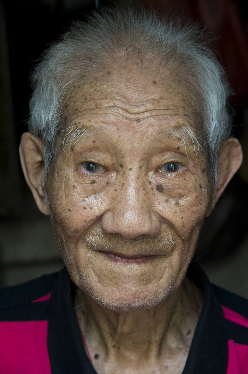 作为一个注重健康的人,他开始关心小脑萎缩患者如何日常饮食的问题.