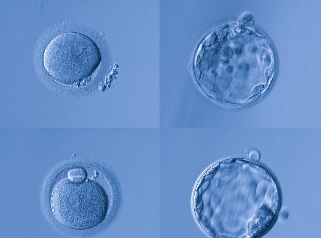 关于卵子的知识,希望你看看