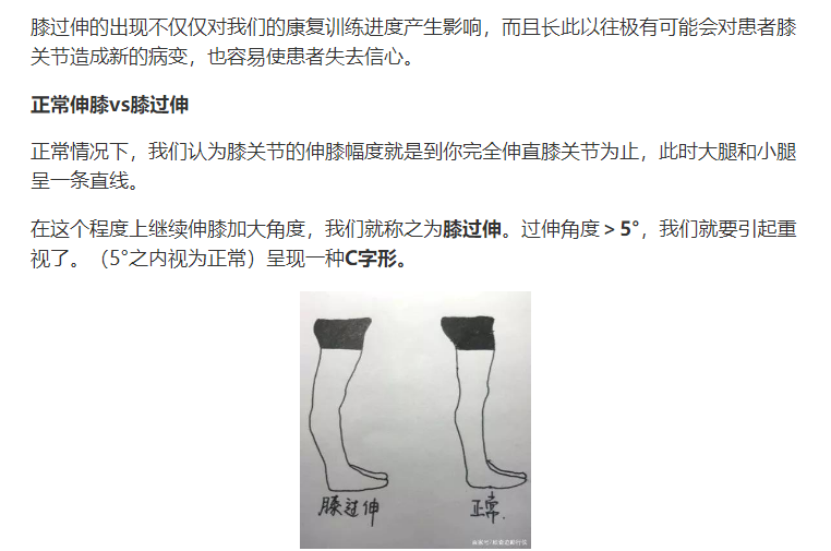 欣奇迹分享|膝过伸的早期预防与康复!