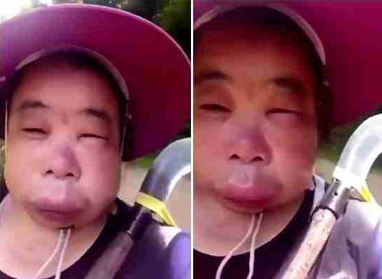 哥哥带着妹妹捅马蜂窝,却被蛰成"猪头",网友:笑出六块腹肌