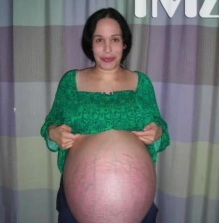 十胞胎怀孕超级大肚子图片