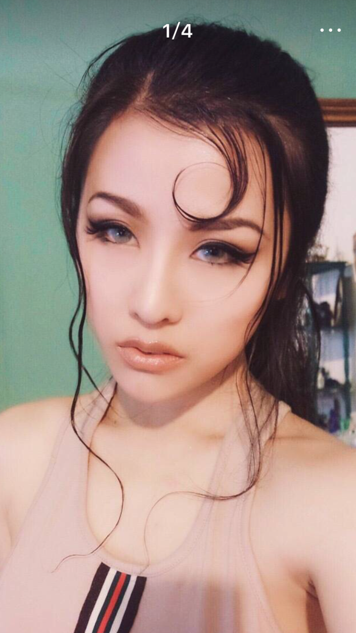 明星整容有人欢喜有人愁:苏梦玫越来越自信,而她假体似贯穿脑门