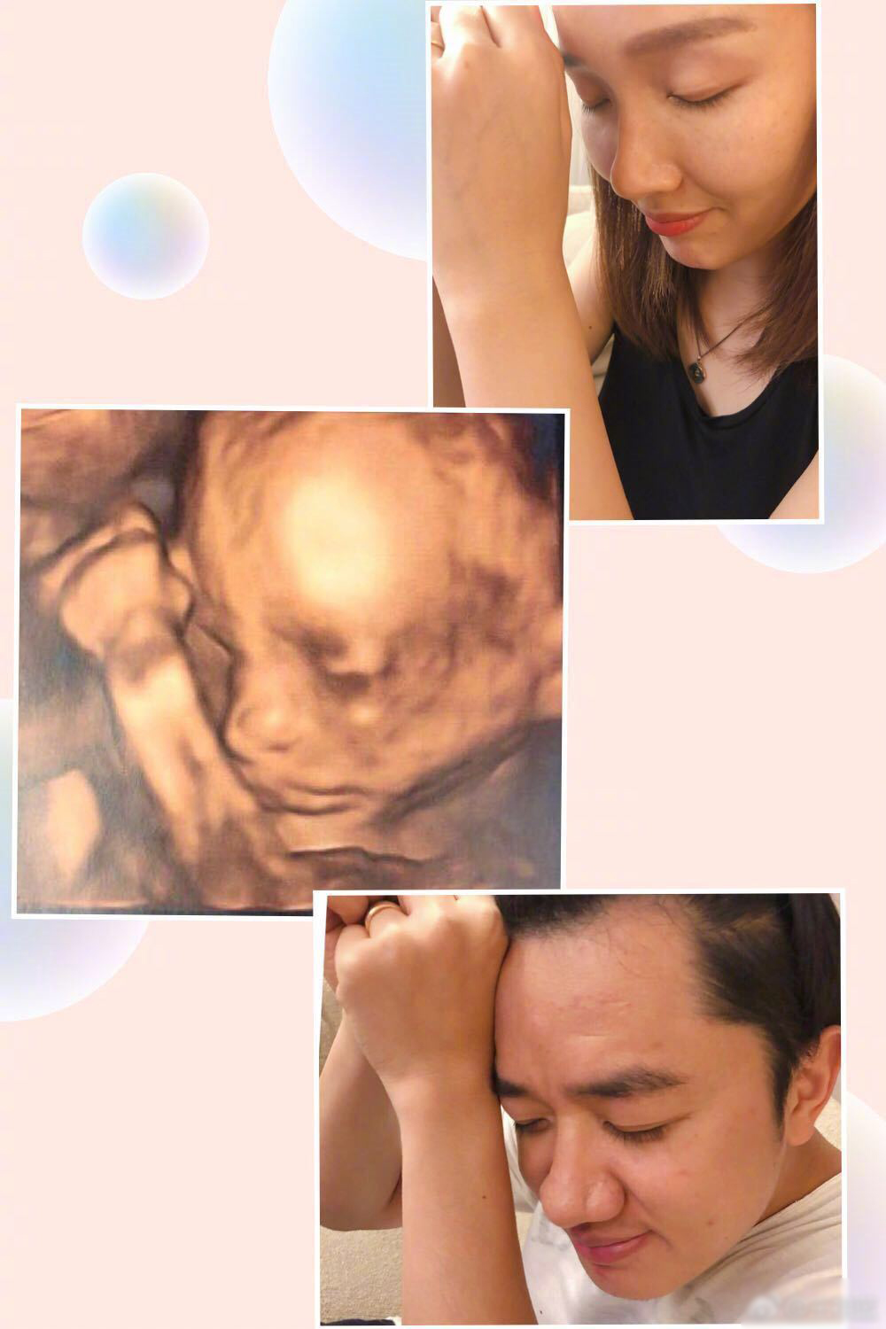 王祖蓝老婆李亚男怀孕还那么美,12月17号她就透露了生了小个女孩