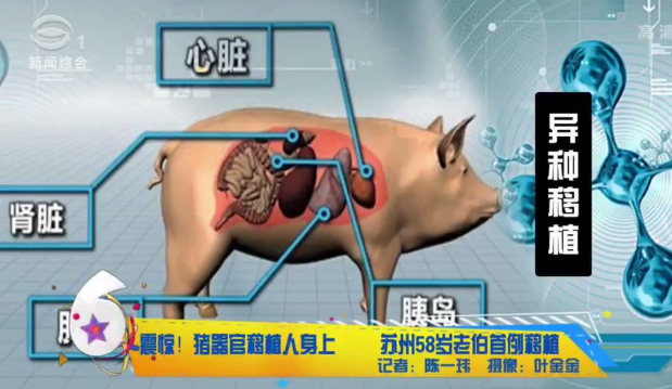 郭广昌说猪的心脏移植到人身上,让人活到120岁,施一公