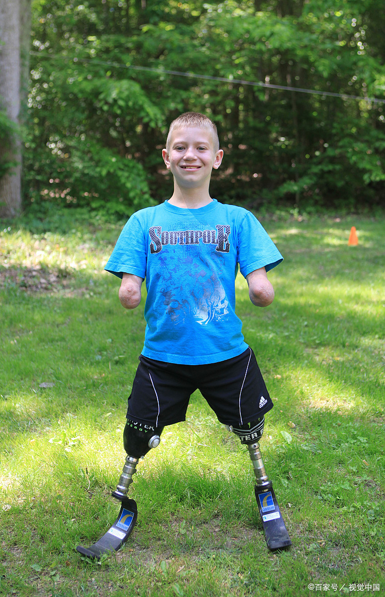 没有四肢的小孩不是重点,假肢以及他开朗乐观的态度才是重点