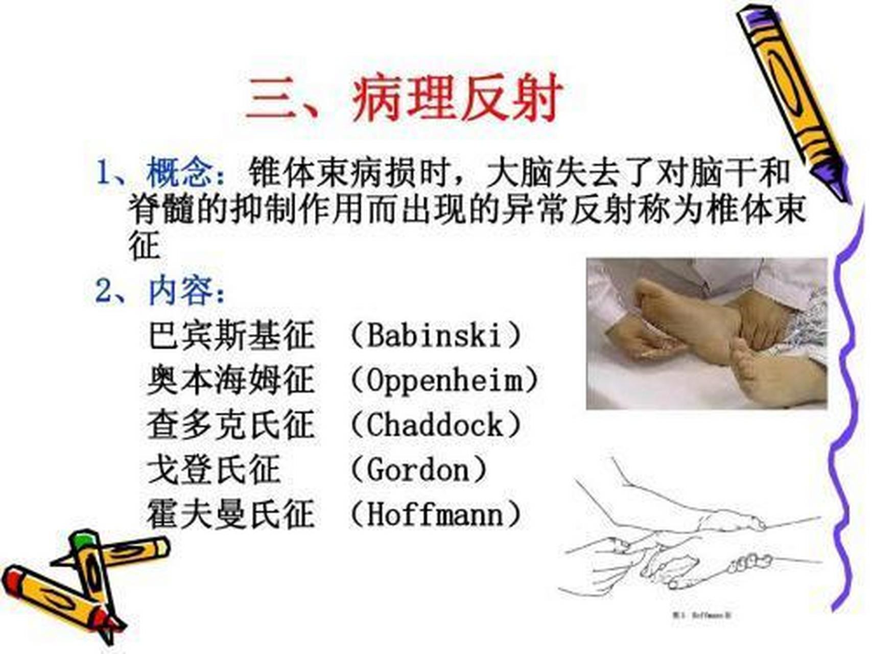 科普知识竞赛#只有中枢神经系统损害时才出现的异常