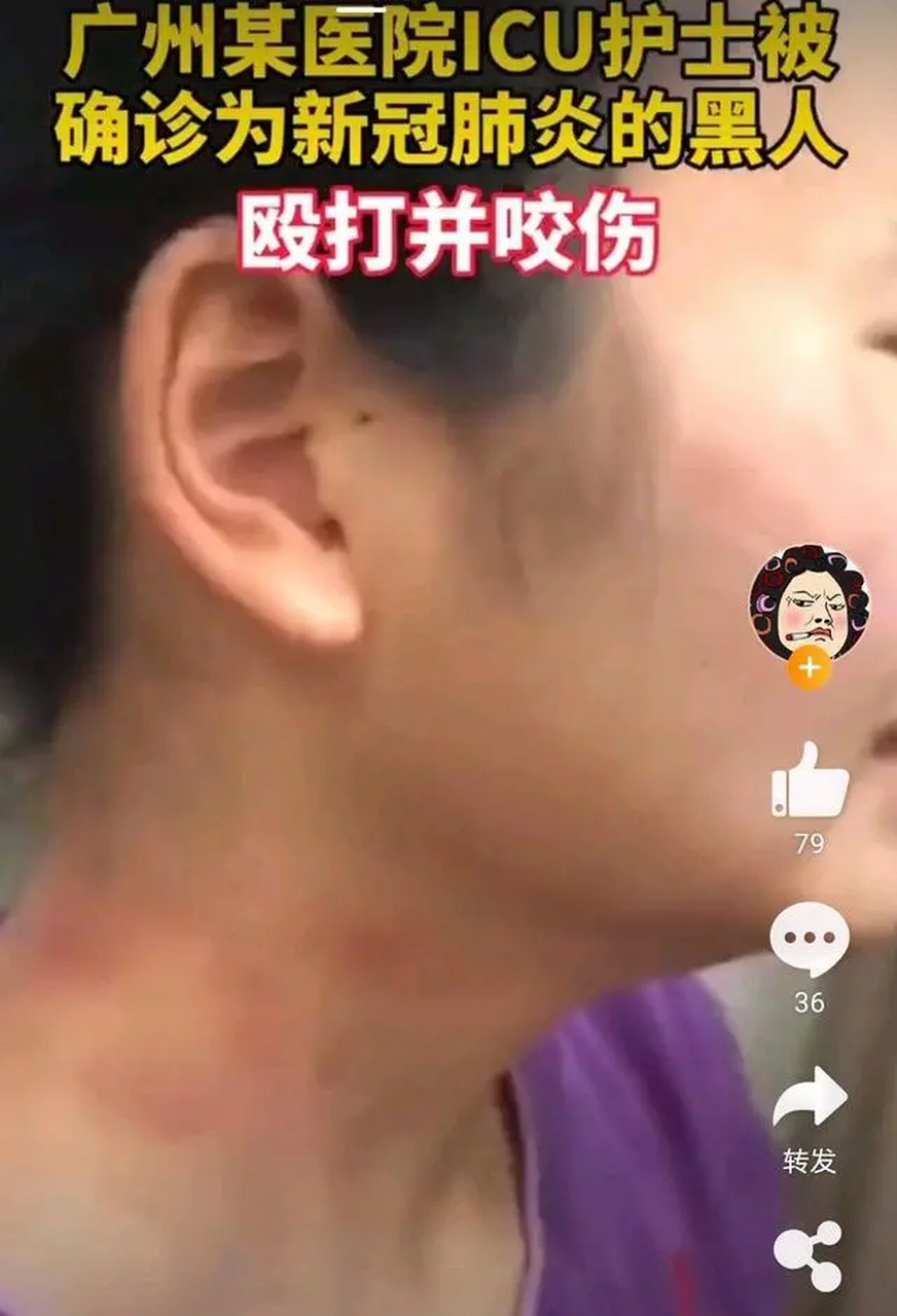 4月1日的两则新闻激发所有中国人强烈愤慨,先是广州一名入境尼籍男子