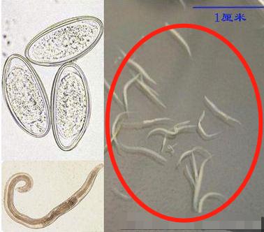 小孩肛门有小白虫图片图片