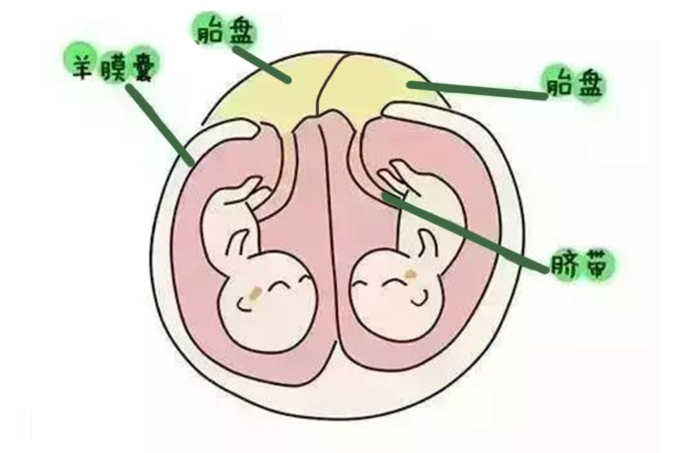 双胞胎在妈妈肚子里如何居住?看到他们抢占地盘