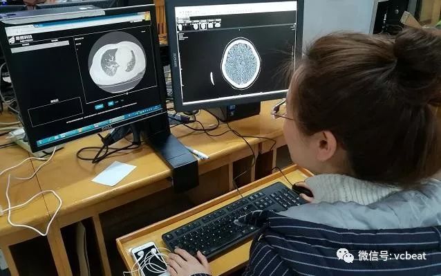 【首发】推想科技完成3亿元新一轮融资,将加速产品落地,扩展,国际化的