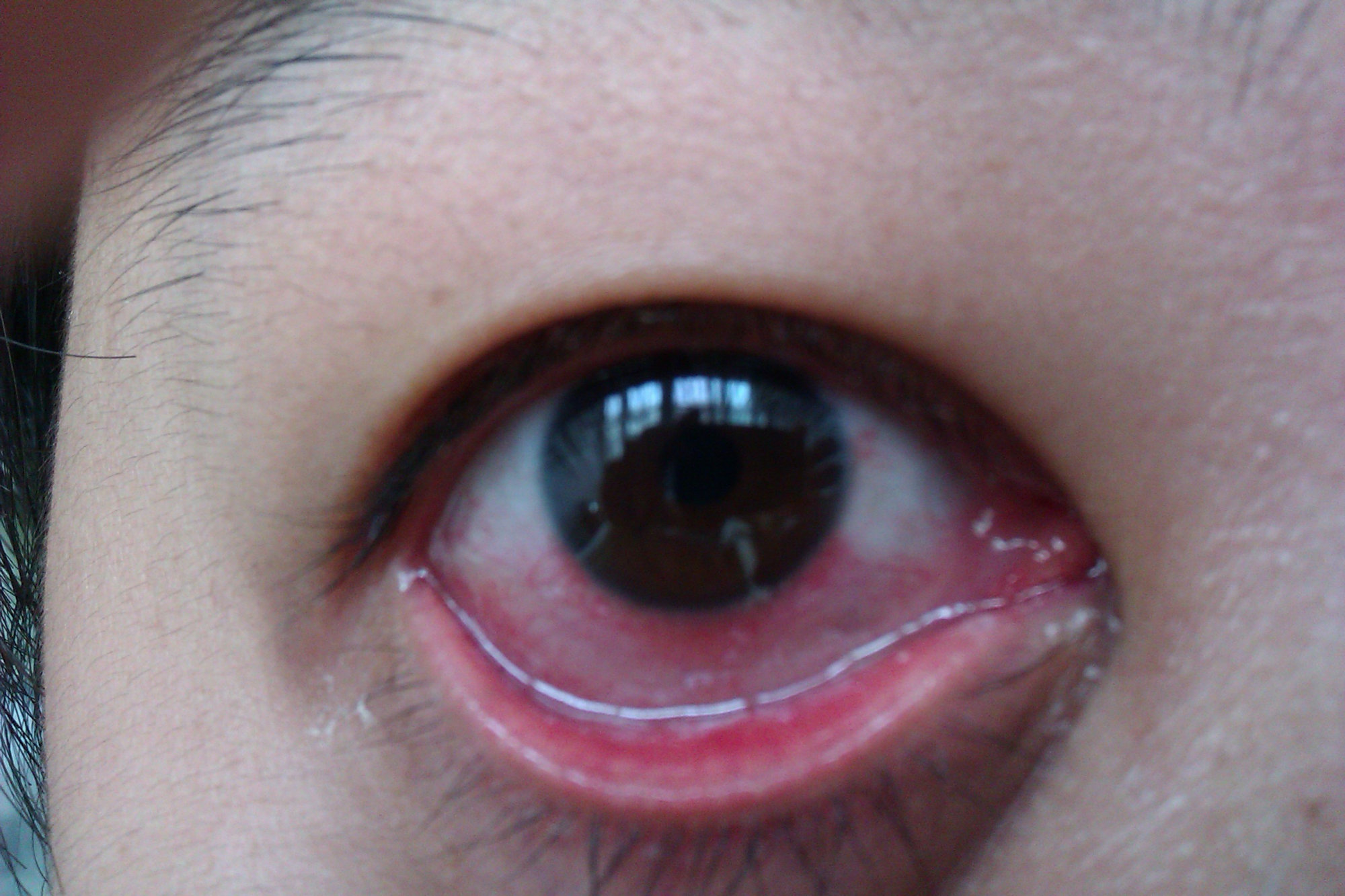 手机蓝光已引发色盲,全球首例病例来自中国台湾,医生给出建议