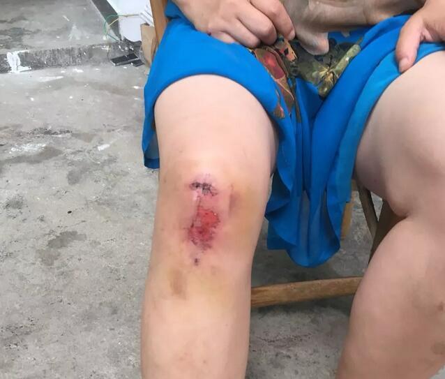 武义老夫妻摔倒流血不止 过路环卫工和护士跪地包扎