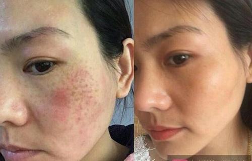 白芷和"它"混合敷脸,不出一个月嫩肤还淡斑,皮肤变得白里透红