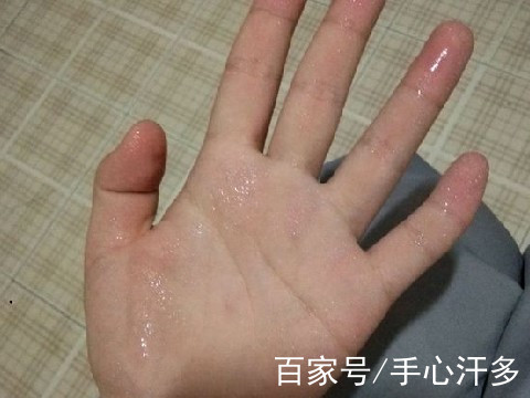手脚心出汗 baijiahao.baidu.com