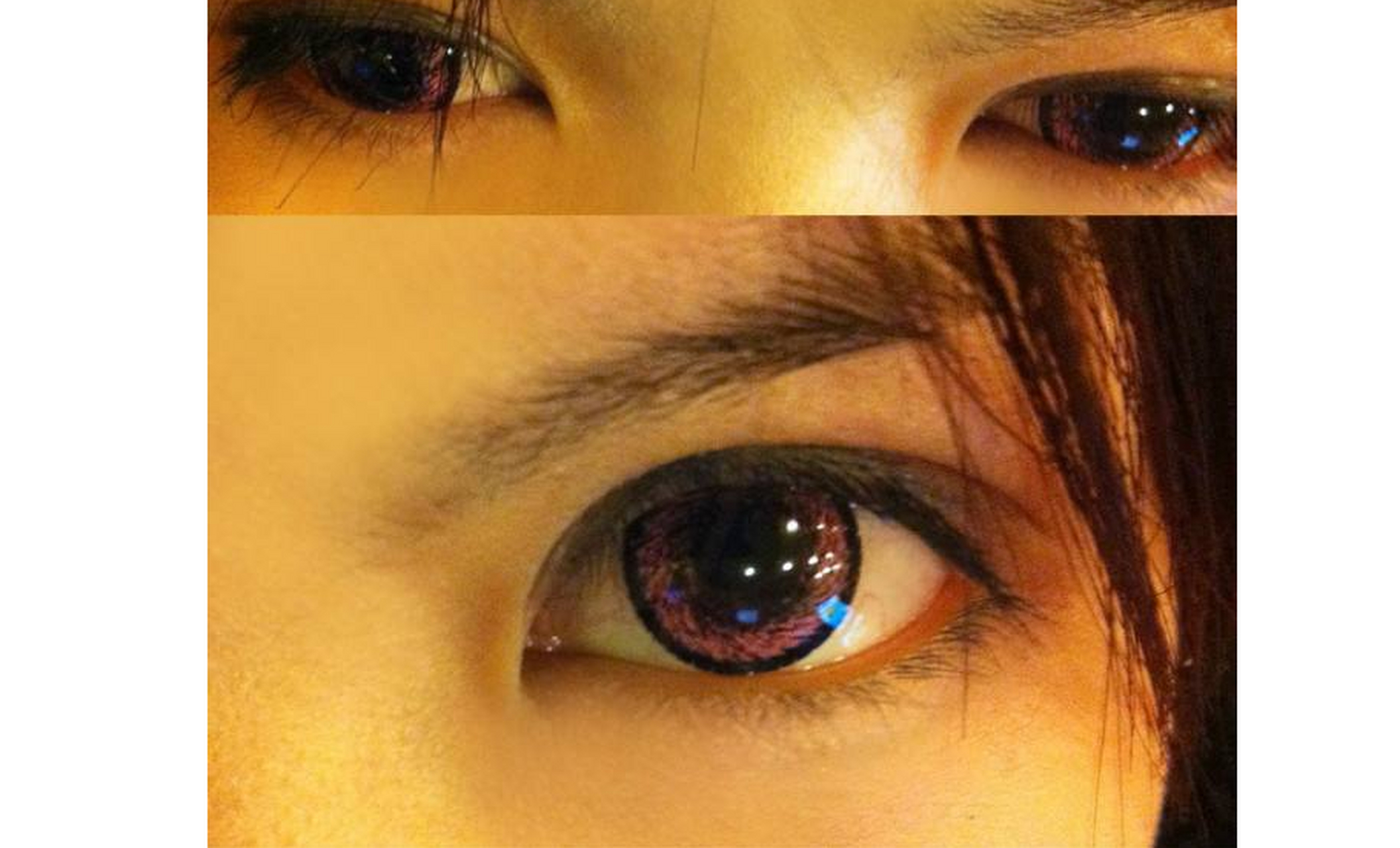 所谓玻璃花眼主要指的是女人眼白较多,或者就是眼睛里面出现玻璃碎裂