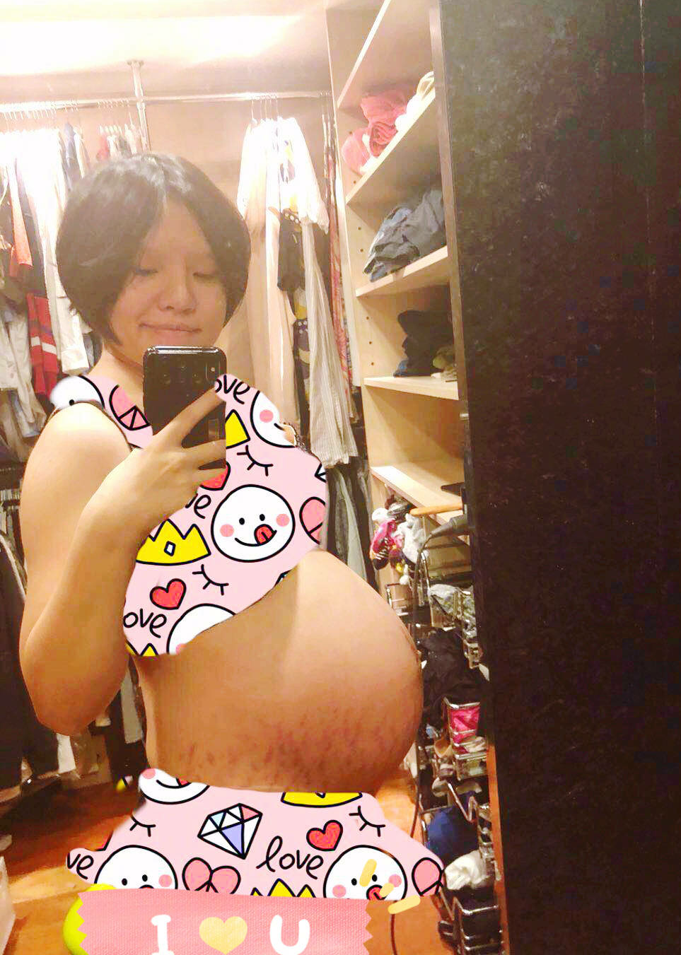 谢依霖大胆晒孕肚照,网友:原来妊娠纹长这样!