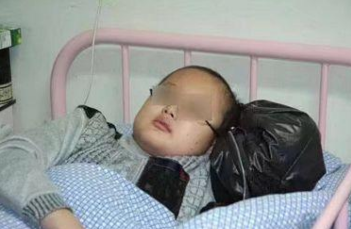 三岁男孩儿患上骨癌,凶手大人孩子都爱,家长长点心吧